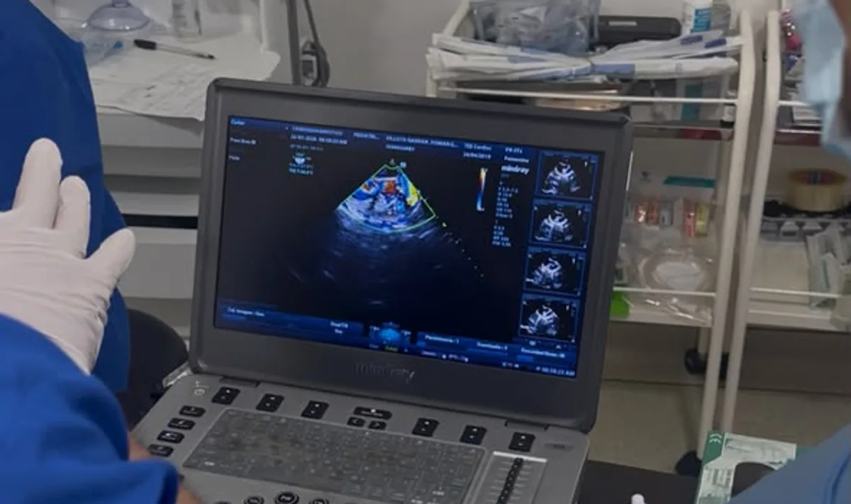 Ecocardiógrafo pediátrico en uso durante un estudio cardíaco