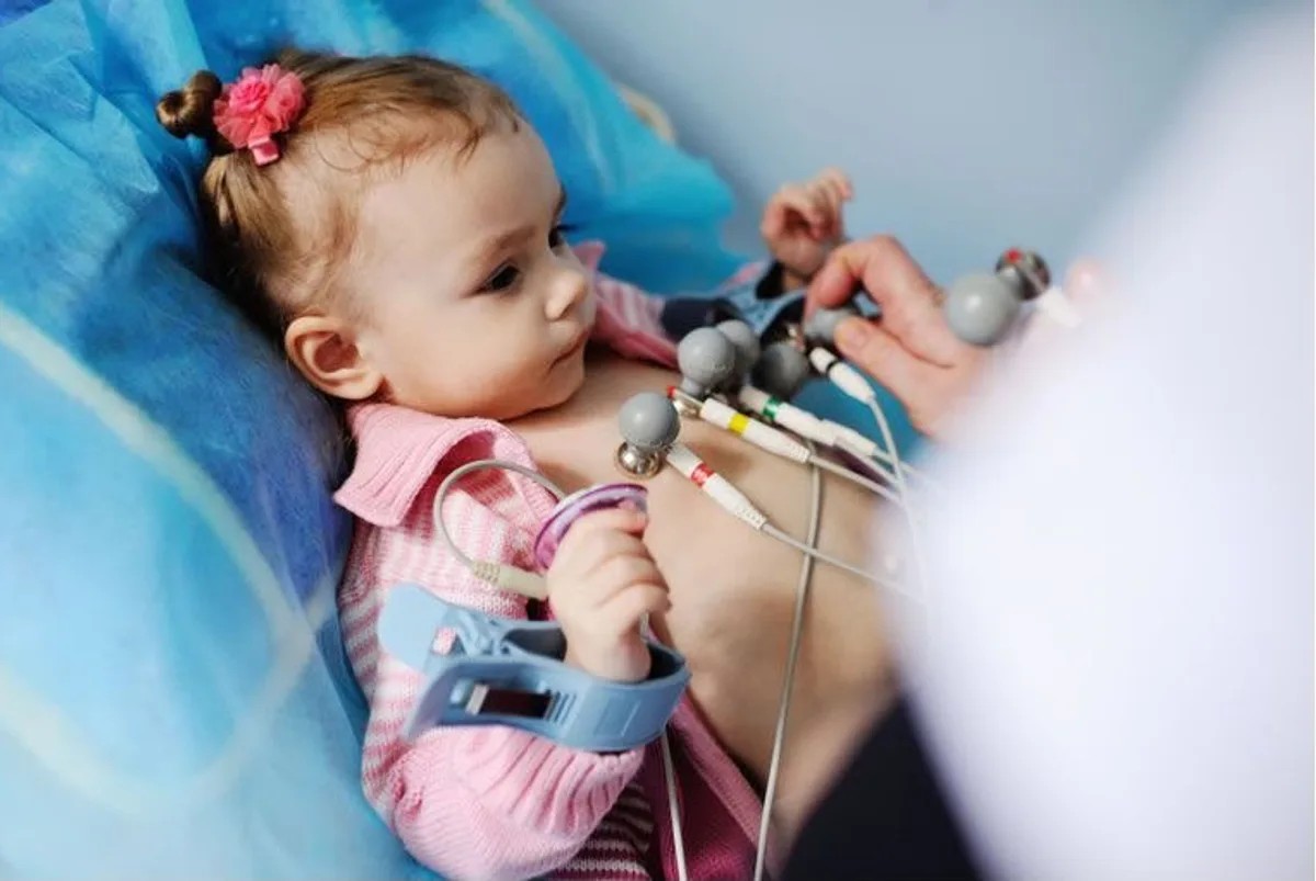 Bebé con electrodos de monitor Holter colocados por personal médico
